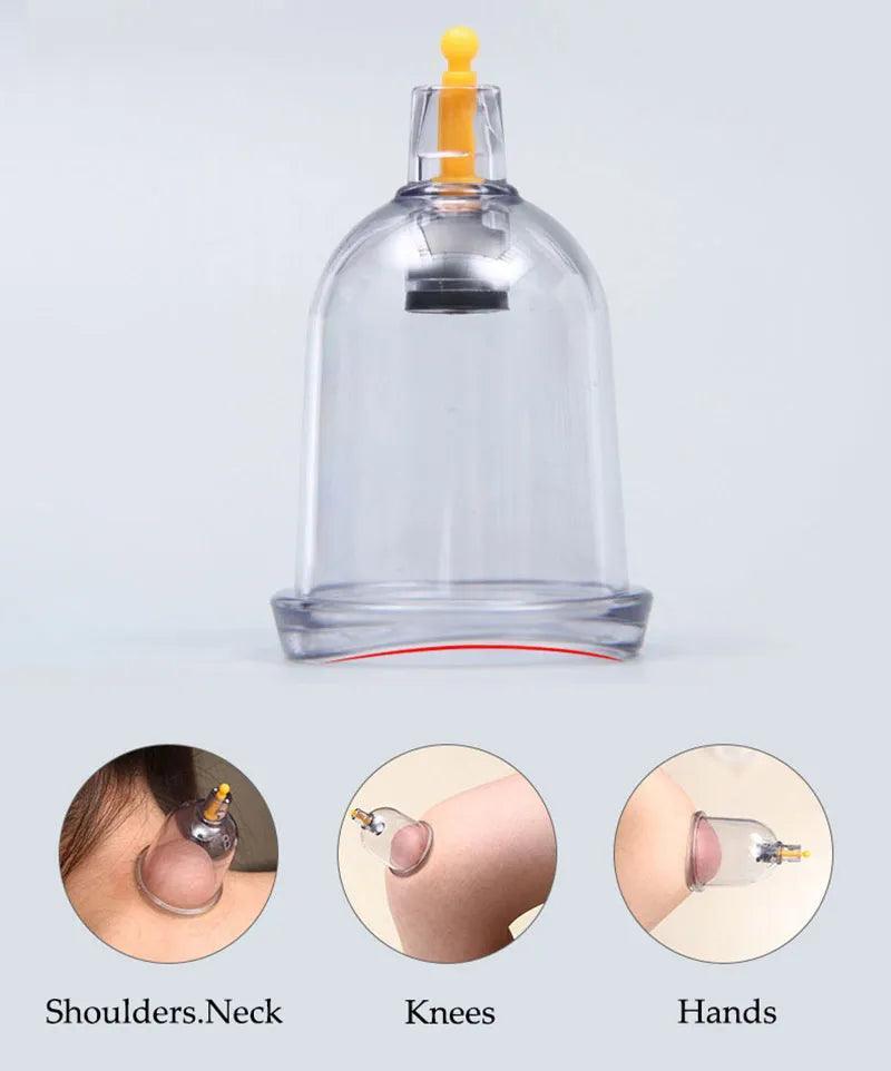 12/24 Can Chinese Medicine Physiotherapy Vacuum Cupping Set for Cellulite Therapy. CHILLSTAR