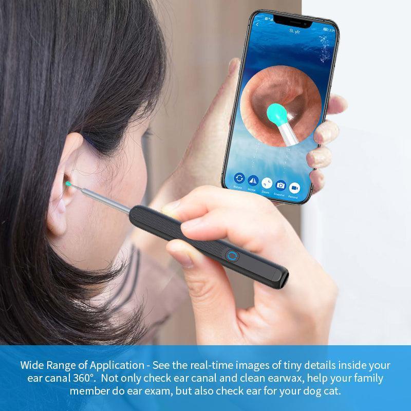 Clear Hear: Wireless Ear Cleaner Otoscope CHILLSTAR